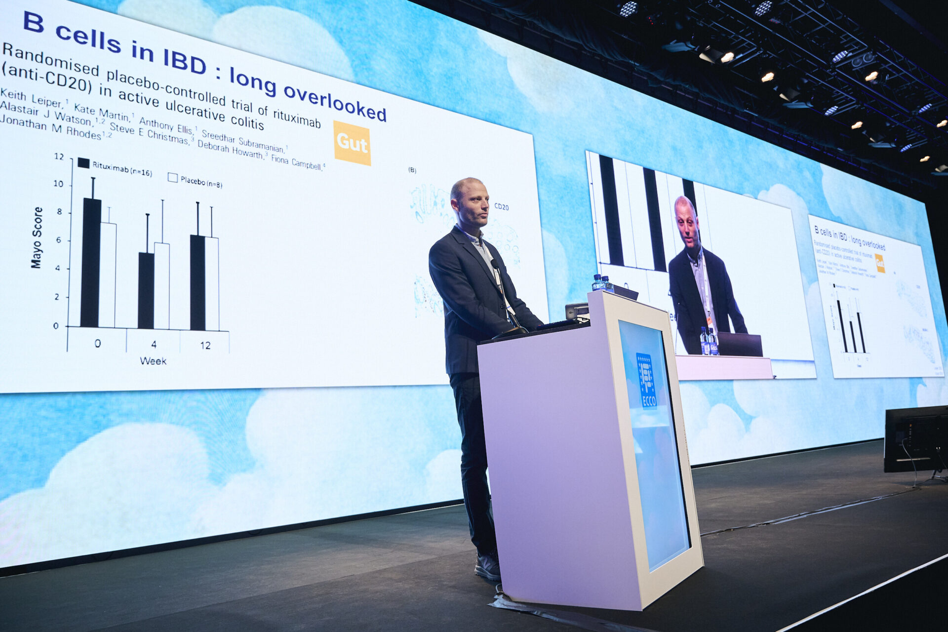 A man stands at a podium giving a presentation on B cells in IBD at a conference. A slide with graphs and text is displayed on a large screen behind him, and another screen shows his image to the audience.